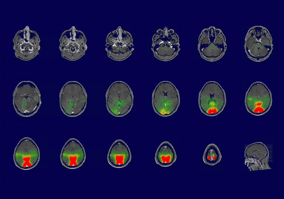Desenho De Bone Eeg 255 Eeg High Res Illustrations Getty Images